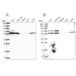 LAP1B Antibody, Novus Biologicals 25 &mu;L; Unlabeled:Antibodies, Polyclonal