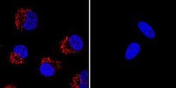 LC3B Antibody (1251A) - BSA Free, Novus Biologicals:Antibodies:Primary