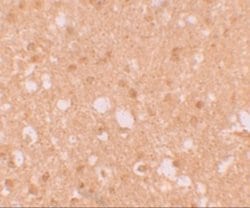 LIN-41/TRIM71 Antibody - BSA Free, Novus Biologicals 0.1mg; Unlabeled:Antibodies,