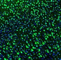 LRPAP Antibody, Novus Biologicals 0.1mL; Unlabeled:Antibodies, Polyclonal