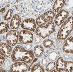 LRPAP Antibody, Novus Biologicals 0.1mL; Unlabeled:Antibodies, Polyclonal