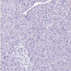 Lactoferrin Antibody, Novus Biologicals 25 &mu;L, Unlabeled:Antibodies,