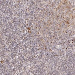 Legumain/Asparaginyl Endopeptidase Antibody, Novus Biologicals 0.1mL; Unlabeled:Antibodies,