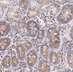 Legumain/Asparaginyl Endopeptidase Antibody, Novus Biologicals 0.1mL; Unlabeled:Antibodies,