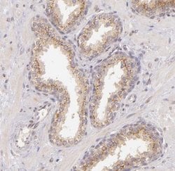 Legumain/Asparaginyl Endopeptidase Antibody, Novus Biologicals 0.1mL; Unlabeled:Antibodies,