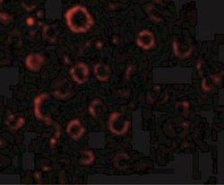 MADD Antibody, Novus Biologicals 0.025mg:Antibodies, Polyclonal