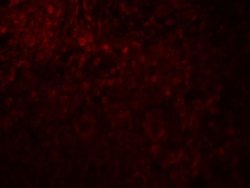 MAGEA4 Antibody - BSA Free, Novus Biologicals:Antibodies:Primary Antibodies