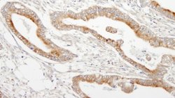 MAP7 Antibody, Novus Biologicals 0.1mL; Unlabeled:Antibodies, Polyclonal