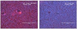 MDR1/ABCB1 Antibody (SN06-42), Novus Biologicals 100&mu;L:Antibodies, Monoclonal