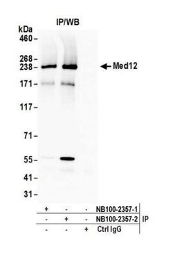 MED12 Antibody, Novus Biologicals 100 &mu;L | Buy Online | Novus Biologicals | Fisher Scientific