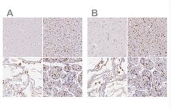 MMR/CD206/Mannose Receptor Antibody, Novus Biologicals 25 &mu;L; Unlabeled:Antibodies,
