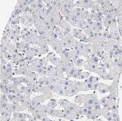 MOSPD2 Antibody, Novus Biologicals 25 &mu;L, Unlabeled:Antibodies, Polyclonal