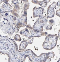 MOSPD2 Antibody, Novus Biologicals 25 &mu;L, Unlabeled:Antibodies, Polyclonal