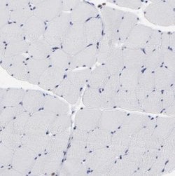 MOSPD2 Antibody, Novus Biologicals 25 &mu;L, Unlabeled:Antibodies, Polyclonal