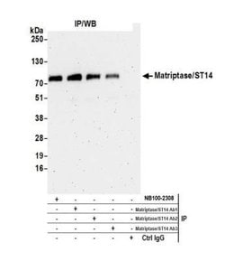 Matriptase/ST14 Antibody, Novus Biologicals 0.1mg; Unlabeled:Antibodies,