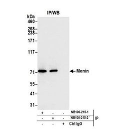 Menin Antibody, Novus Biologicals 0.1mg; Unlabeled:Antikroppar