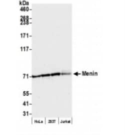 Menin Antibody, Novus Biologicals 0.1mg; Unlabeled:Antikroppar