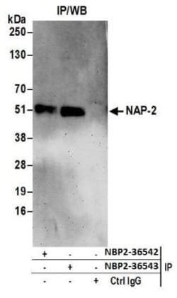 NAP1L4 Antibody, Novus Biologicals 100 &mu;L | Buy Online | Novus Biologicals | Fisher Scientific