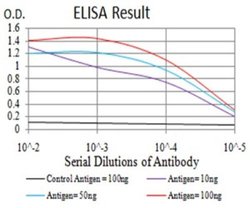 NF-M Antibody (1B6B12) - BSA Free, Novus Biologicals 0.1 ml; Unconjugated:Antibodies,