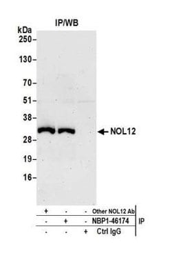 NOL12 Antibody, Novus Biologicals 0.1mg; Unlabeled:Antibodies, Polyclonal