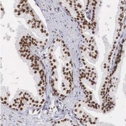 NSBP1 Antibody, Novus Biologicals 0.1mL; Unlabeled:Antibodies, Polyclonal