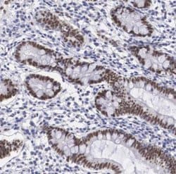 NSBP1 Antibody, Novus Biologicals 0.1mL; Unlabeled:Antibodies, Polyclonal