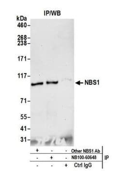 Nbs1 Antibody, Novus Biologicals 0.1mL; Unlabeled:Antibodies, Polyclonal