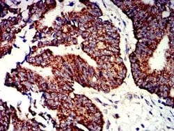 P2Y1/P2RY1 Antibody (4G5D6) - BSA Free, Novus Biologicals:Antibodies:Primary