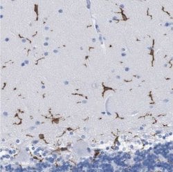 P2Y12/P2RY12 Antibody, Novus Biologicals 0.1mL; Unlabeled:Antibodies