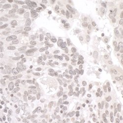 PALB2 Antibody, Novus Biologicals 0.1mg; Unlabeled:Antibodies, Polyclonal