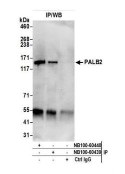 PALB2 Antibody, Novus Biologicals 0.1mg; Unlabeled:Antibodies, Polyclonal