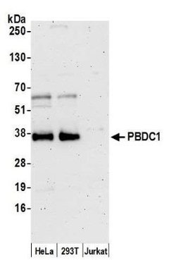 CXorf26 Rabbit anti-Human, Polyclonal, Novus Biologicals 100&mu;L:Antibodies,
