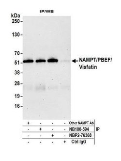 PBEF/Visfatin/NAMPT Antibody (BLR058F), Novus Biologicals 100 &mu;L | Buy Online | Novus Biologicals | Fisher Scientific