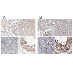 PCM1 Antibody, Novus Biologicals 25 &mu;L; Unlabeled:Antibodies, Polyclonal