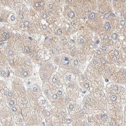 PCM1 Antibody, Novus Biologicals 25 &mu;L; Unlabeled:Antibodies, Polyclonal