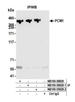 PCM1 Antibody, Novus Biologicals 0.1mL; Unlabeled:Antibodies, Polyclonal