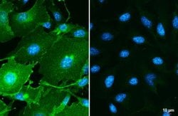 PD-L1 Antibody, Novus Biologicals 0.1mL; Unlabeled:Antibodies, Polyclonal