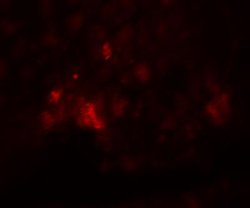 PD-L1 Antibody - BSA Free, Novus Biologicals 0.025mg; Unlabeled:Antibodies,