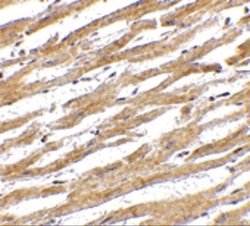 PD-L1 Antibody - BSA Free, Novus Biologicals 0.025mg; Unlabeled:Antibodies,