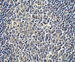 PD-L1 Antibody - BSA Free, Novus Biologicals 0.025mg; Unlabeled:Antibodies,