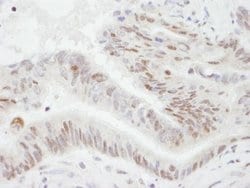 PGC1 alpha Antibody, Novus Biologicals 0.1mL; Unlabeled:Antibodies, Polyclonal