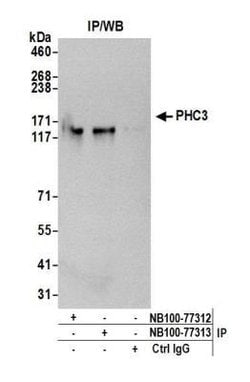 PHC3 Antibody, Novus Biologicals 0.1mg; Unlabeled:Antibodies, Polyclonal