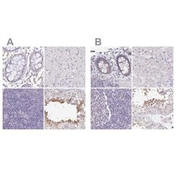 PLCD4 Antibody, Novus Biologicals 0.1mL; Unlabeled:Antibodies, Polyclonal