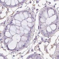 PLCD4 Antibody, Novus Biologicals 0.1mL; Unlabeled:Antibodies, Polyclonal