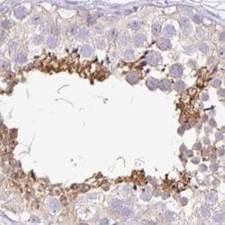 PLCD4 Antibody, Novus Biologicals 0.1mL; Unlabeled:Antibodies, Polyclonal