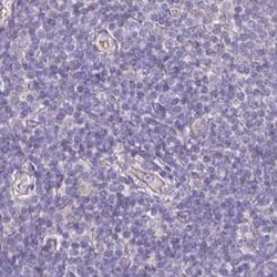 PLCD4 Antibody, Novus Biologicals 0.1mL; Unlabeled:Antibodies, Polyclonal