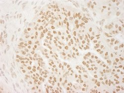 PRMT6 Antibody, Novus Biologicals 0.1mg; Unlabeled:Antibodies, Polyclonal