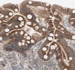 anti-PTGER4/EP4, Polyclonal, Novus Biologicals 0.1mL; Unlabeled:Antibodies,
