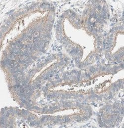 anti-PTGER4/EP4, Polyclonal, Novus Biologicals 0.1mL; Unlabeled:Antibodies,