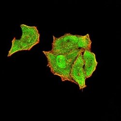 PTPN14/PTPD2 Antibody (2C12E3) - BSA Free, Novus Biologicals 0.1 ml; Unconjugated:Antibodies,